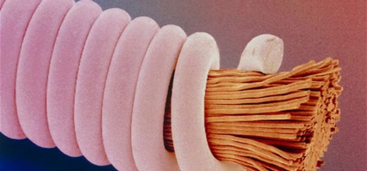 Có nên thay dây đàn guitar thường xuyên?